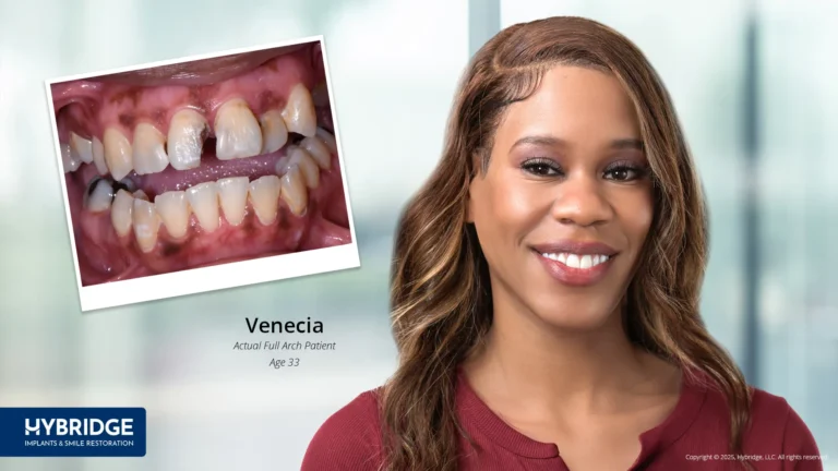 Dental Implants Grand Rapids, MI