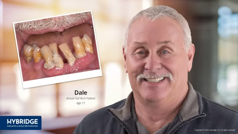 Dental Implants Lansing, MI